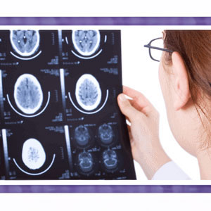 Are Head Injuries Immediately Noticeable After An Accident?